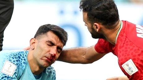 REPORTAJ. Mănuși peste suferință: povestea tulburătoare a portarului iranian Alireza Beiranvand, absent azi de la Mondial după accidentarea groaznică din meciul cu Anglia