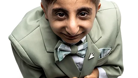 Cum arată bărbatul cu cele mai scurte palme din lume! Afshin Ghaderzadeh a intrat în Cartea Recordurilor