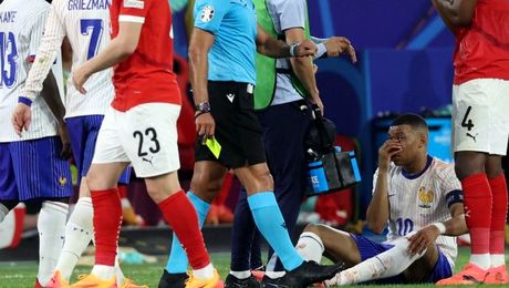 Cum a apărut Mbappe la antrenamentul de astăzi al Franței, la două zile după ce a făcut fractură la nas și a ieșit sângerând din teren